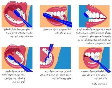 اینفوگرافیک/ روش صحیح مسواک زدن | اقتصاد24