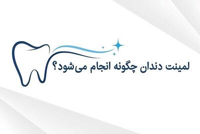 لمینت دندان چگونه انجام می‌شود و مناسب چه کسانی است؟