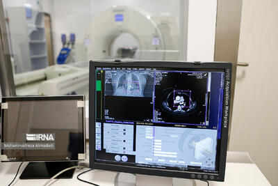 بسیاری از تومورهای سرطانی در ایران قابل تشخیص و درمان شده‌اند