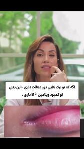 شش نکته که چهره هر کسی درباره سلامتی اش می گوید + فیلم