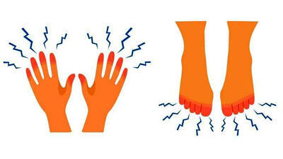 خواب رفتن دست و پا نشانه چیست؟ / جدول مقایسه و روش درمان