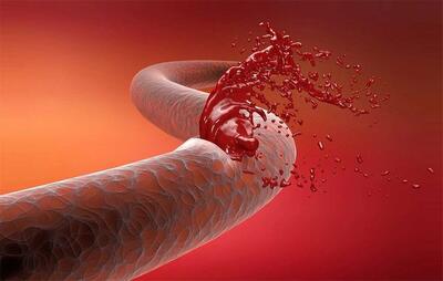 نانو‌دارو جدید به کمک درمان خونریزی‌های شدید می‌آید