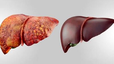 6 عادت روزمره که برای کبد خطرناک هستند