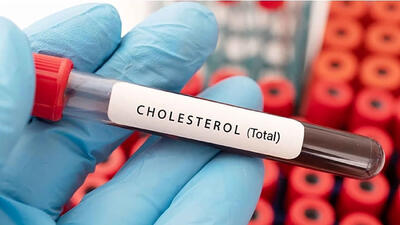 total cholesterol در آزمایش خون چیست؟