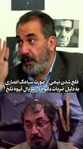 (ویدئو) ماجرای فلج شدن نیمی از صورت سیامک انصاری برای بازی در سریال مهران مدیری