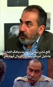 فلج شدن صورت سیامک انصاری بر اثر ضربه های باتوم