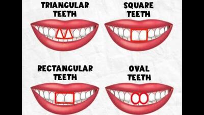 شخصیت شناسی از روی شکل دندان ها / شکل دندان ها ویژگی های شخصیتی شما را آشکار می کند