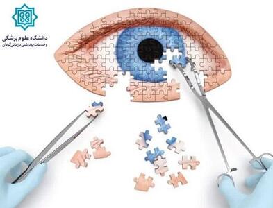 انجام عمل جراحی ایجاد پنجره بر روی غلاف اعصاب بینایی در کرمان