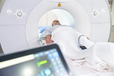 استقرار ۶ دستگاه MRI در لرستان