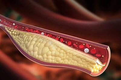 این ویتامین قاتل کلسترول بالاست