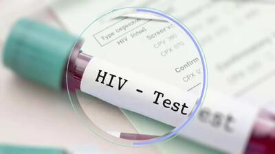 hiv ab چیست؟ + فیلم