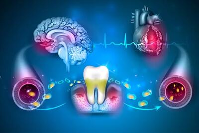 ویدیو/ آیا باکتری‌های دهان بر زوال عقل تاثیر دارند؟