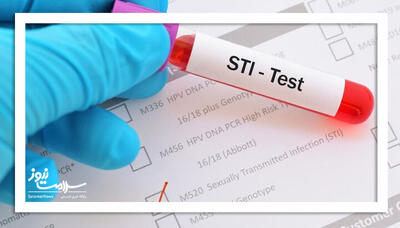 سوالات متداول در مورد بیماری های مقاربتی