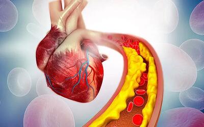 این گیاه دارویی کلسترول خون را کاهش می دهد