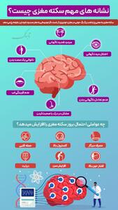 نشانه های مهم سکته مغزی چیست؟