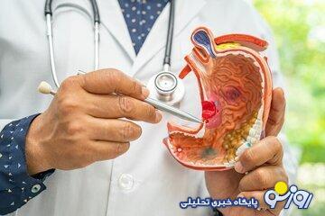 علائم سرطان معده | روزنو