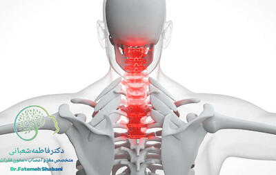 دیسک گردن باعث چه دردهایی می‌شود؟