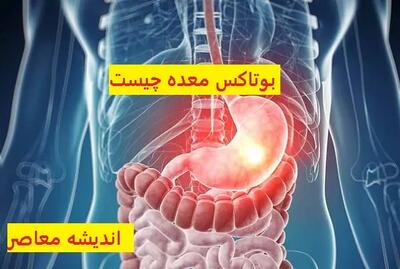 بوتاکس معده چیست | بوتاکس معده باعث لاغری میشود اندیشه معاصر