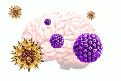 نقش دو ویروس رایج در شروع بیماری آلزایمر