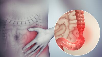 چگونه یبوست را درمان کنیم؟