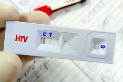 ویروس HIV قابل کنترل است به شرط درمان