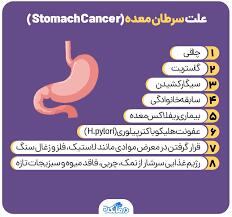 علائم خطر سرطان معده و راه‌های پیشگیری - سبک ایده آل