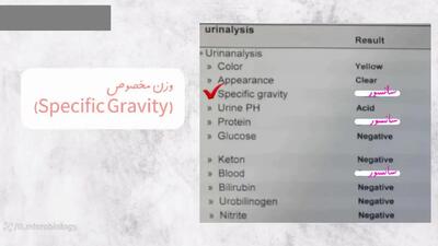 urine analysis چیست + فیلم