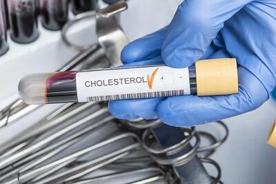 آزمایش Cholesterol + شرایط انجام آن