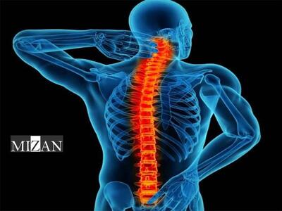 ضربه به سر و ستون فقرات خطر پنهان در تصادفات رانندگی