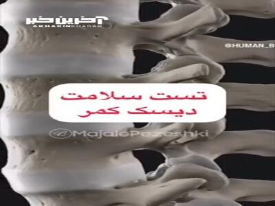 تست سلامت دیسک کمر