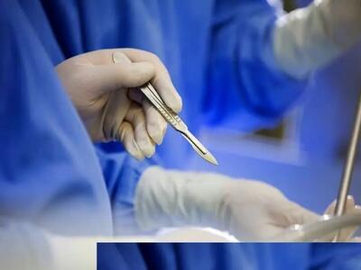 خارج کردن توده ۵ کیلویی از شکم خانم سنندجی