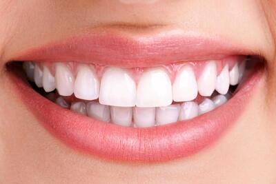 میوههای خشک برای دندانها ضرر دارند؟