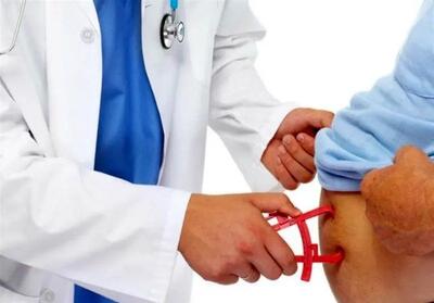 روند افزایشی چاقی/نقش کارشناسان تغذیه در سلامت جامعه