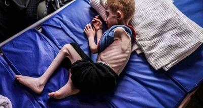 290 هزار کودک در نوار غزه در آستانه مرگ - تسنیم