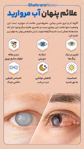 اینفوگرافی| علائم پنهان آب مروارید