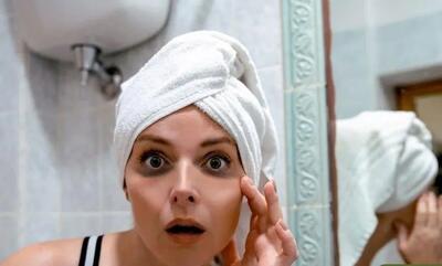 شش راه‌حل برای از بین بردن پف و تیرگی زیر چشم