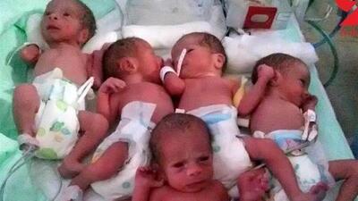 مستمری حمایتی بهزیستی برای خانواده‌های صاحب فرزند چندقلو
