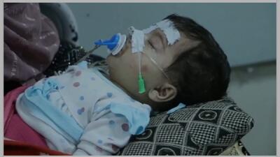 هشدار سازمان بهداشت جهانی نسبت به شیوع سرخکان در افغانستان