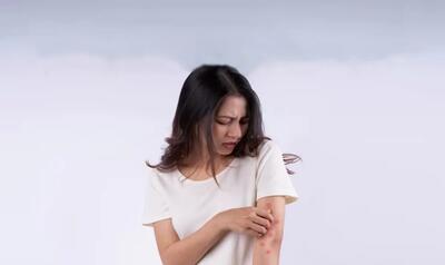 دلایل به وجود آمدن بیماری لوپوس چیست؟