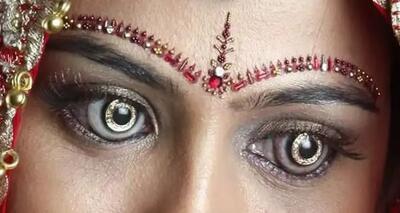 یک روند جدید در پزشکی؛ تزریق طلا به چشم انسان