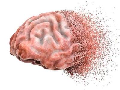 افراد چگونه به زوال عقل مبتلا می‌شوند؟