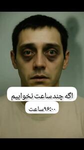 تاثیر کم خوابی بر چهره براساس میزان ساعت کم خوابی