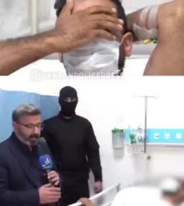 ۱۳ گلوله پلیس در پای شرور تحت تعقیب