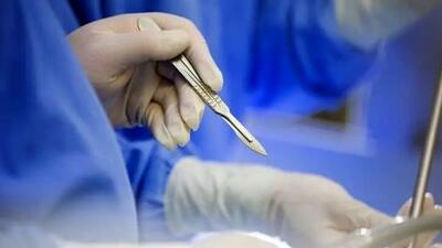 مرگ زن 35 ساله بعد از عمل اسلیو معده