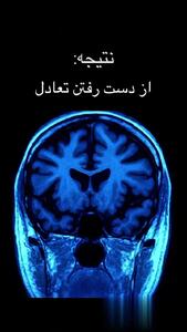 تصاویری غم انگیز از تحلیل رفتن مغز + فیلم