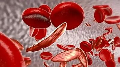 بتا تالاسمی مینور؛ چالش‌ها و راهکارهای زندگی بهتر