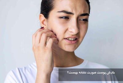 خارش پوست صورت نشانه چیست؟ درمان دارویی و خانگی خارش پوست صورت