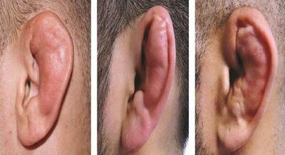 چند می‌گیری گوش بشکنی؟ | جهان نیوز