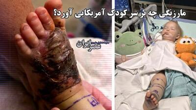 نجات معجزه‌آسای دختر ۱۵ ماهه پس از گزش مار زنگی در آریزونا (فیلم)