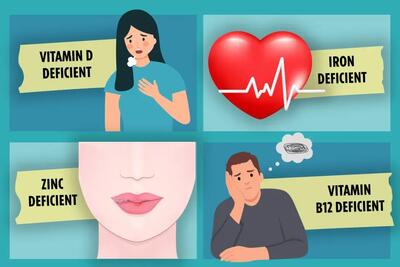 ۶ زنگ خطر در بدن: این علائم یعنی کمبود ویتامین دارید! (راهنمای متخصصان تغذیه)